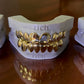 GOLD GRILLZ (NEW)