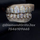 YELLOW GOLD VVS CUSTOM GRILLZ