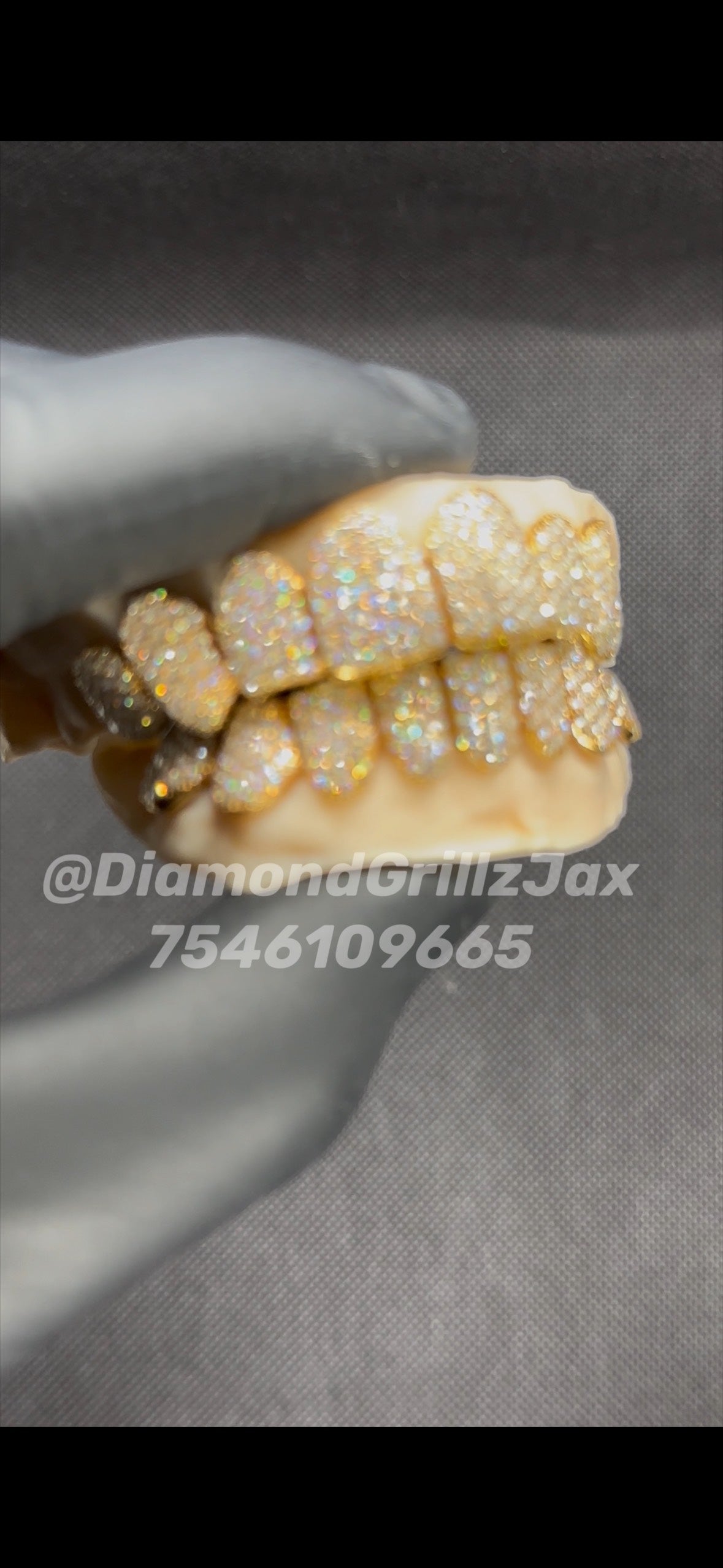 YELLOW GOLD VVS CUSTOM GRILLZ