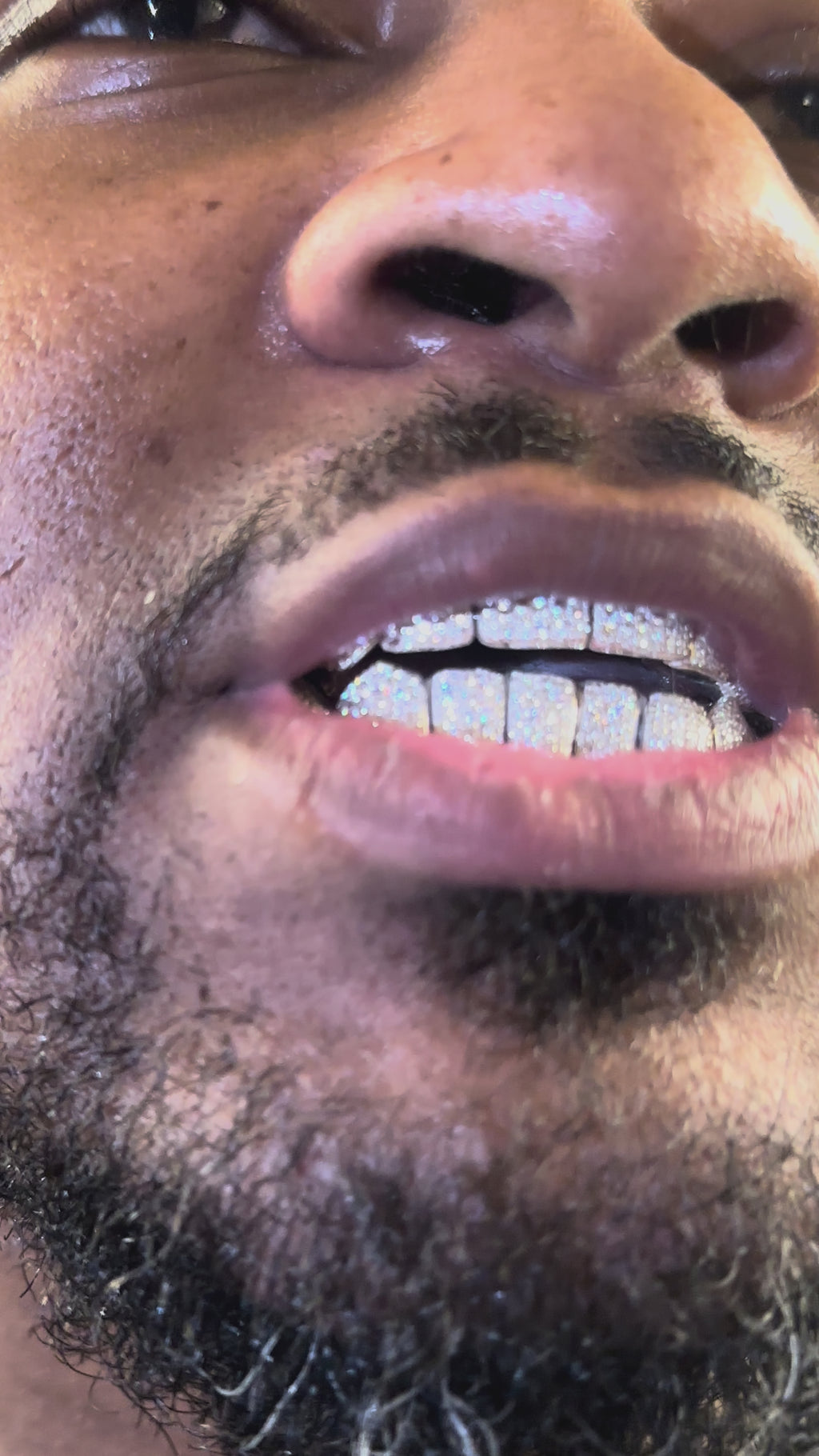 WHITE GOLD VVS CUSTOM GRILLZ