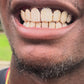 YELLOW GOLD VVS CUSTOM GRILLZ